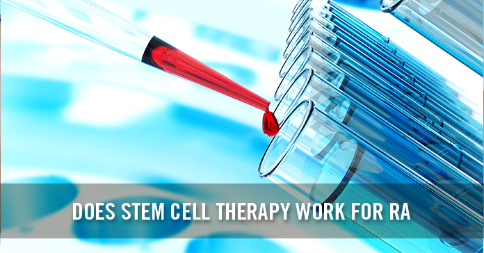 stem cell therapy for rheumatoid arthritis